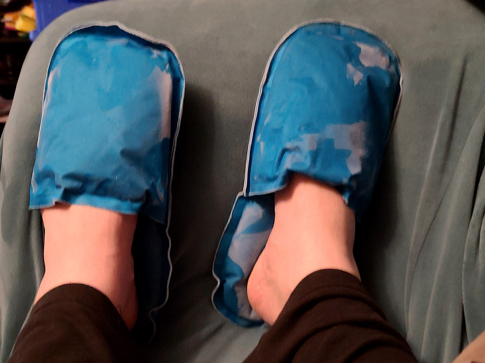 Slipper shaped ice packs on swollen feet.